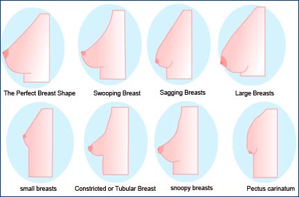breast-shapes-new.jpg