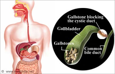Side Effects of Turmeric: Gall Bladder