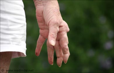 Health Benefits of Turmeric: Rheumatoid Arthritis