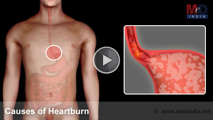 bücher verkaufen Fantastische 7 Causes Of Heartburn ~ Mar 2016 