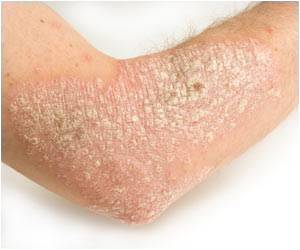 Can a leg rash become cancer?