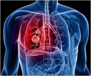 Beta Blockers And Copd
