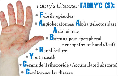 Fabry's Disease