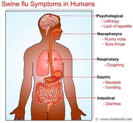human swine flu  symptoms