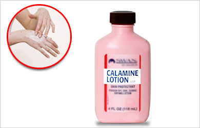 how to apply calamine lotion chicken pox
