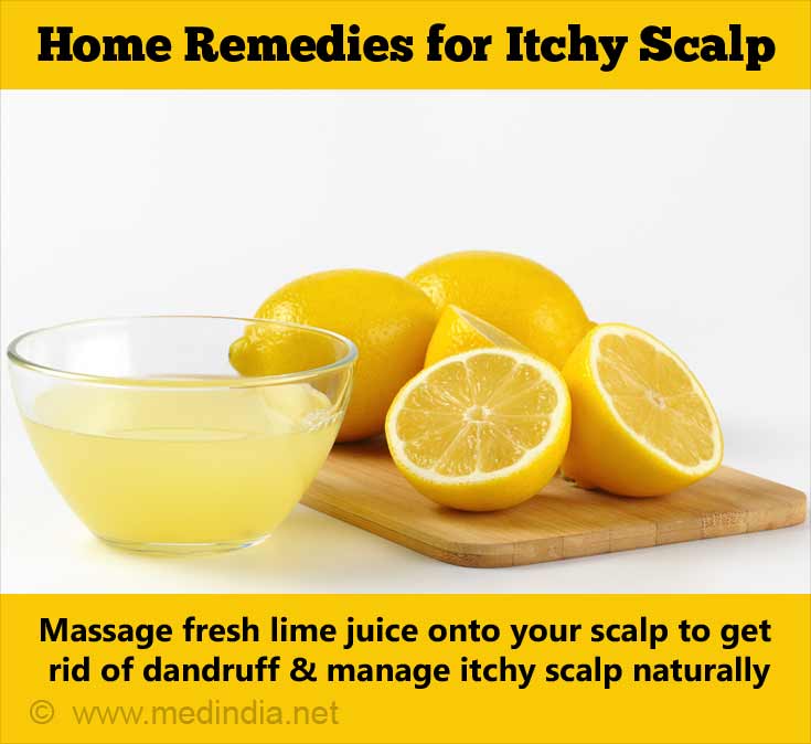 What are some home remedies for itchy scalp?