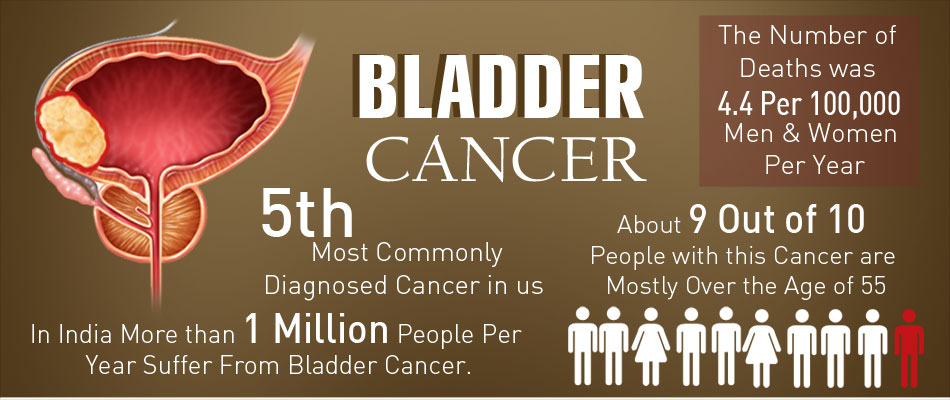 Are all bladder tumor diagnoses cancerous?
