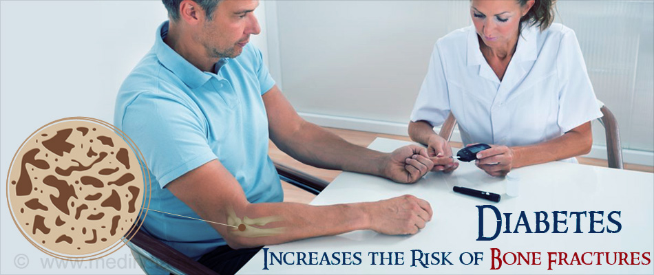 Diabetes Increases the Risk of Bone Fracture