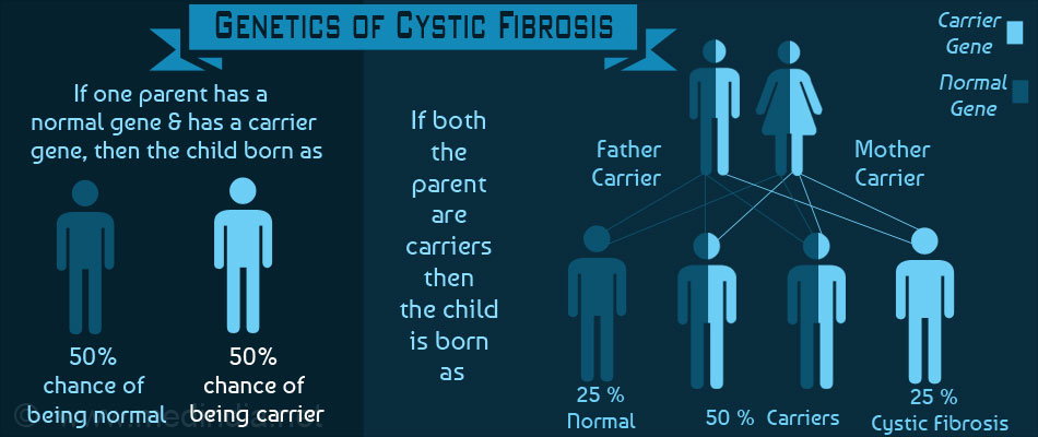 genetic-of-cystic-fibrosis