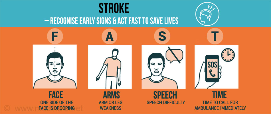 Stroke Recognise and Act FAST