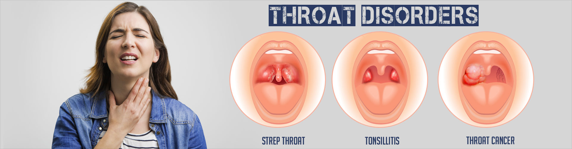 Throat Disorder 89