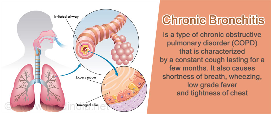 Chronic Bronchitis Causes Symptoms Diagnosis Treatment And Prevention