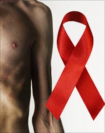 Symptom Hiv