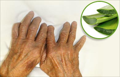 Health Benefits of Aloe Vera: Arthritis