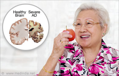 Health Benefits of Apples: Alzheimer