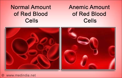 Health Benefits of Ragi: Anemia
