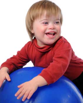 Signs And Symptoms Of Down Syndrome In Infants