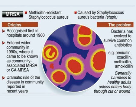 Universal screening for MRSA may be too costly