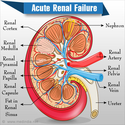 Is renal symptoms what failure Renal Failure: