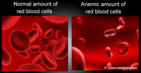 What disease is a result of low red blood cell count and low hemoglobin?