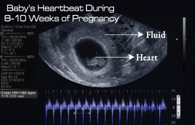 Pregnant Heart Beat 39