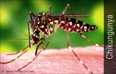Chikungunya Causes Symptoms Diagnosis Treatment FAQs