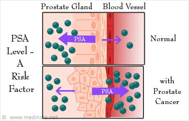 Why is the prostate-specific antigen test done?