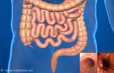 How are small intestine problems diagnosed?