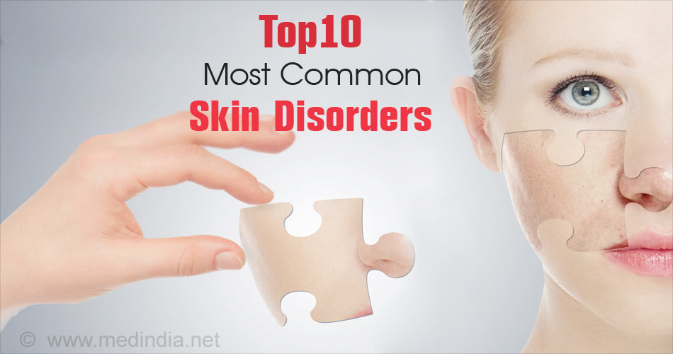 Ten Most Common Skin Disorders