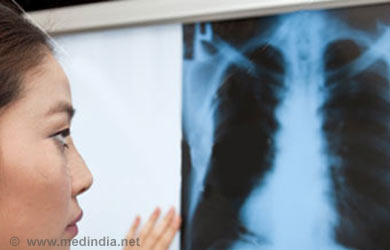 How can we Diagnose Tuberculosis?