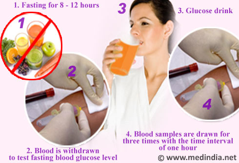 Oral Glucose Tolerance Test Procedure 26