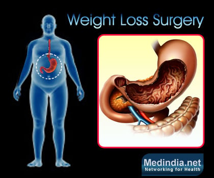 weight-loss-surgery.jpg