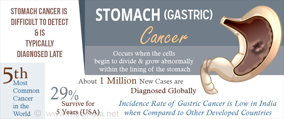 Facts About Stomach Cancer