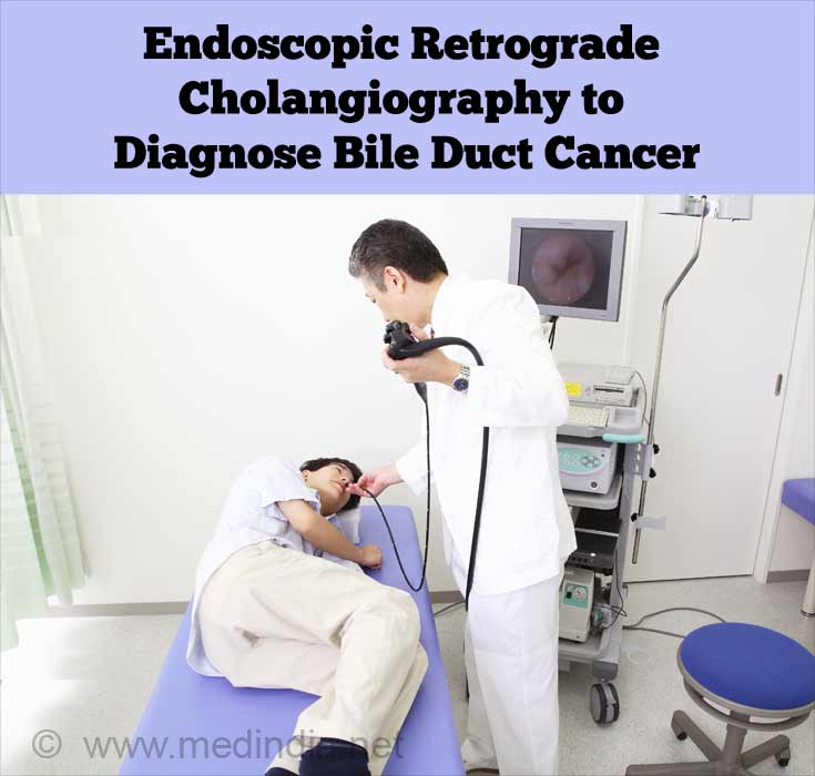 Endoscopic Retrograde Cholangiography to Diagnose Bile Duct Cancer