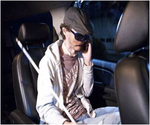 'Reverse Craniofacial Planning' Called For By Face Transplantation