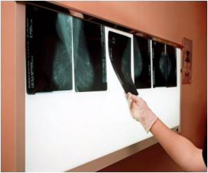  Overweight Reduces Odds of Surviving Breast Cancer: Study