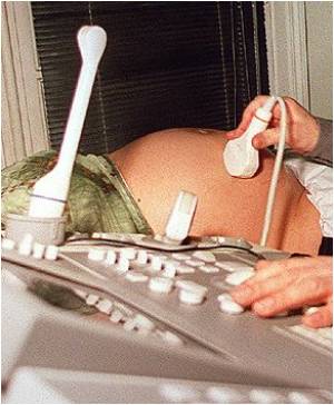  Depressed Mothers Must Opt for Child Care