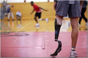 Limb Regeneration Studied in Detail Limb Regeneration Studied in Detail