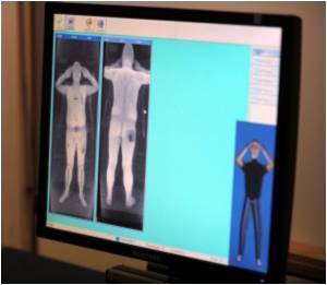Blood-Brain Barrier Damaged In Inherited Metabolic Diseases Blood-Brain Barrier Damaged In Inherited Metabolic Diseases