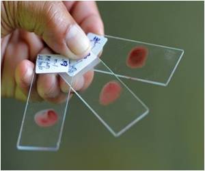 Risk of Multidrug-Resistant Infection Increases With Each Day of Hospitalization Risk of Multidrug-Resistant Infection Increases With Each Day of Hospitalization