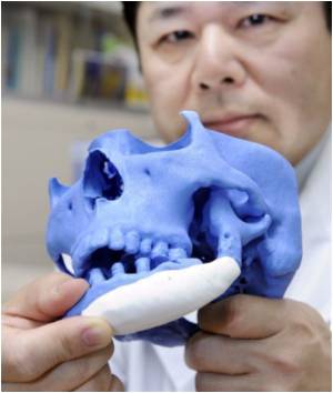  Distraction Osteogenesis Proves Useful in Patients With Cleft Palate