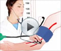 How to Measure Blood Pressure - Animation