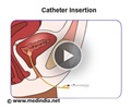 Catheter Insertion In Females