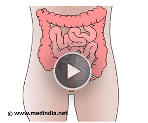 Intussusception