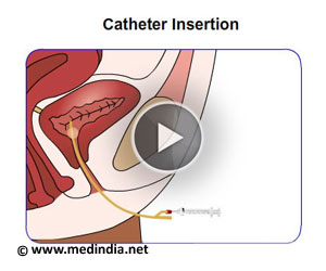 Female Catheterization