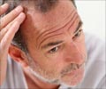Loss of Hair - Beauty Tips