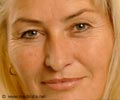 Face Wrinkles - Beauty Tips