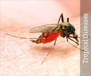 Tropical Diseases Health Center : articles, news, videos, animations, quizzes, calculators and drugs