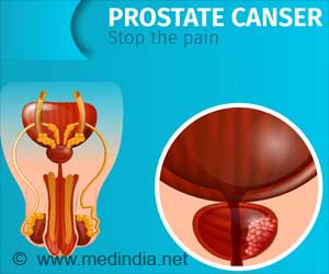 Common Prostate Cancer Drugs Were Less Safe: New Study