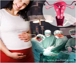 Fibroid Surgery Reduces Miscarriages in Certain Women